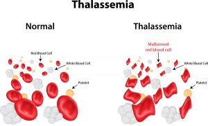 Thalassemia blood