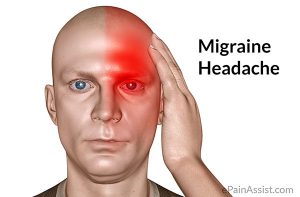 Migraine Headache Migraine Headaches migraines blood vessels migraine