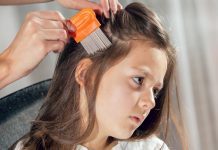 How to Get Rid of Head Lice in a Natural Way lice