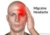 Migraine Headaches Migraine Headache Migraine Headaches migraines blood vessels migraine