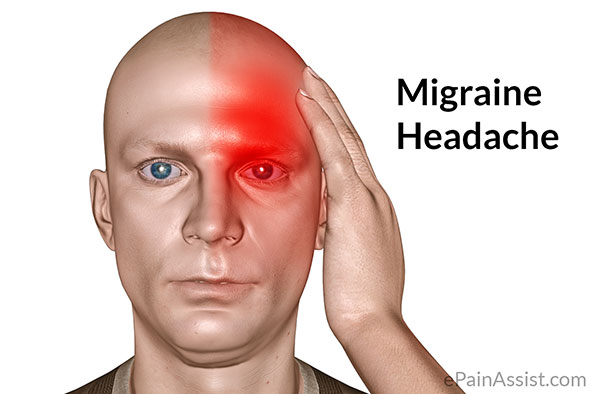 Migraine-Headache Migraine Headache Migraine Headaches migraines blood vessels migraine