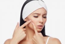Treating Acne vulgaris with domestic components acne vulgaris