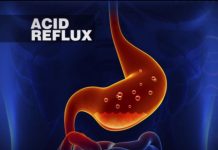 How to Relieve Acid Reflux Symptoms: Ways to Treat Symptoms of Acid Reflux