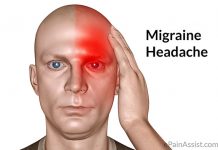 The Migraine: Intense and Continuous Pain on One Side of the Head