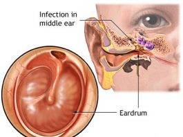 ear infection ear infections