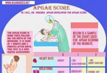 Newborn Apgar Scoring: Babies Are Checked One Minute After Birth for Better Medical Care one minute after birth immediate medical attention apgar 100 beats per minute